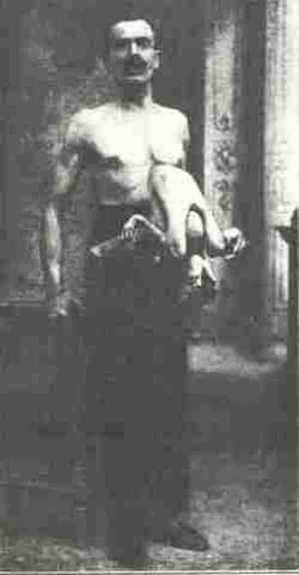 Double-Bodied Man